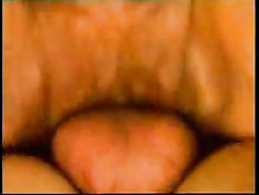 At Least You Don't Have To Worry About Teeth