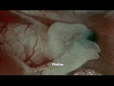 Он вылизал волосатую пизду жене и оттрахал в миссионерской позе