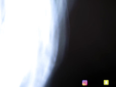 Счастливый парень отымел молодую блондинку раком во влагалище и анус